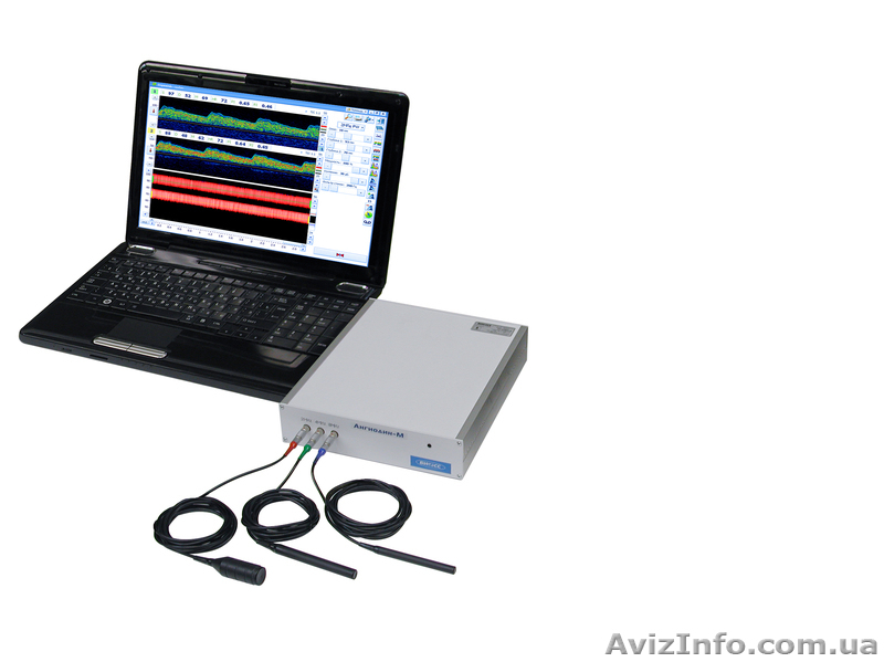 Кардиограф, допплер, энцефалограф, миограф, реограф Хмельницкий - <ro>Изображение</ro><ru>Изображение</ru> #6, <ru>Объявление</ru> #1047833